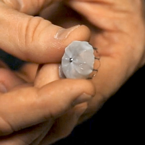 A close-up of a hand holding a Watchman device, a type of LAA occlusion therapy used to treat atrial fibrillation
